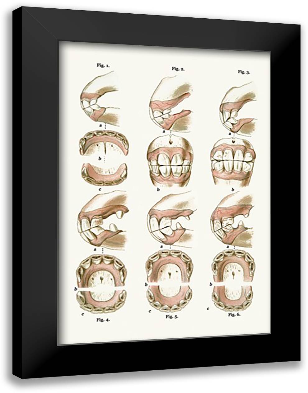 Teeth Plate Description 16x22 Black Modern Wood Framed Art Print Poster by Sidney, S.