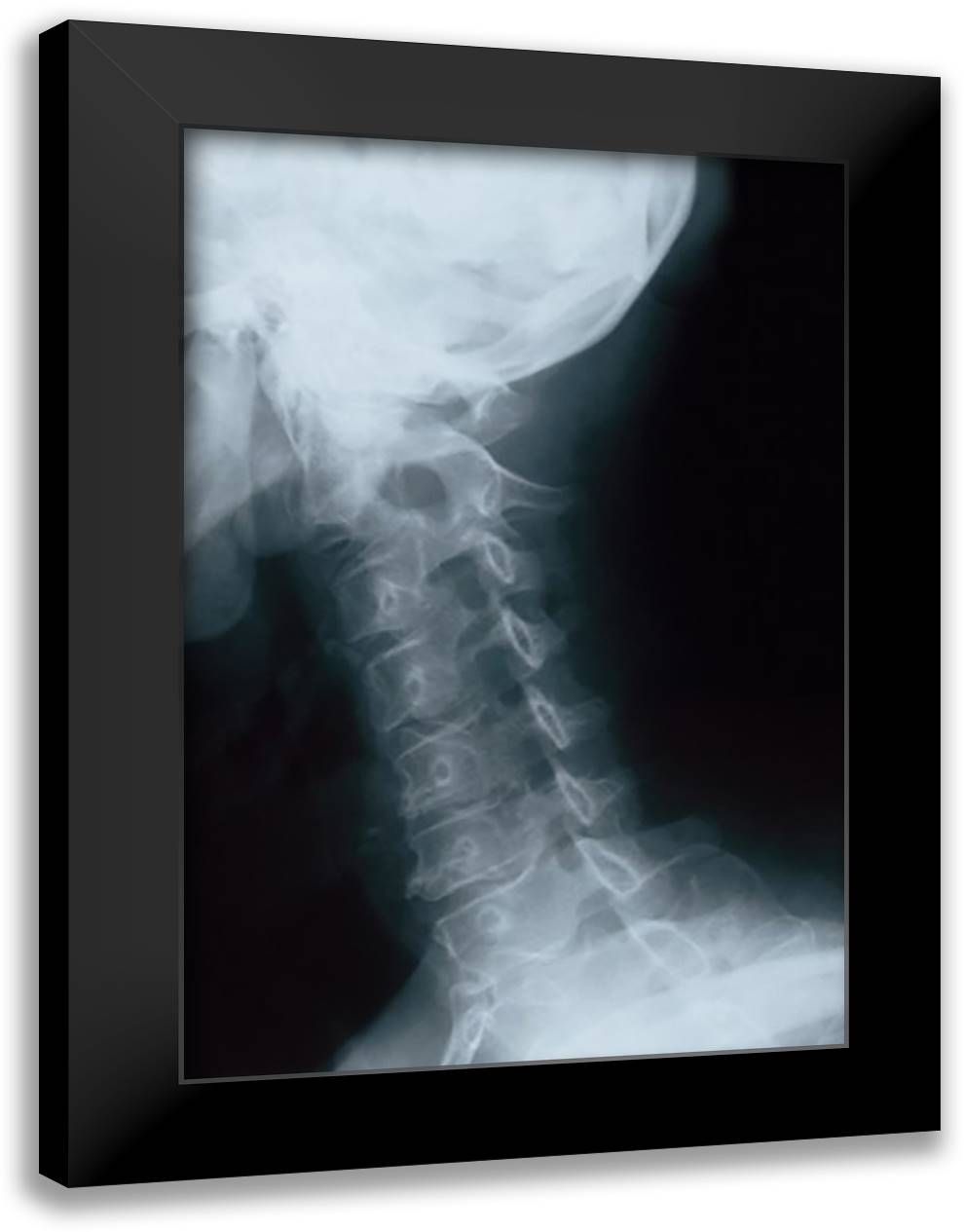 Neck 16x22 Black Modern Wood Framed Art Print Poster