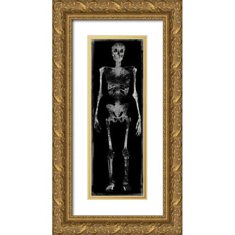Skeleton III Gold Ornate Wood Framed Art Print with Double Matting by Wagner, Martin