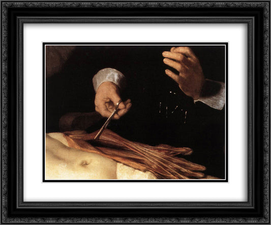 The Anatomy Lesson of Dr. Nicolaes Tulp(fragment) 24x20 Black Ornate Wood Framed Art Print Poster with Double Matting by Rembrandt