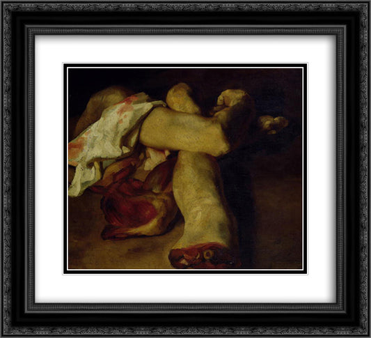 Anatomical Pieces 22x20 Black Ornate Wood Framed Art Print Poster with Double Matting by Gericault, Theodore