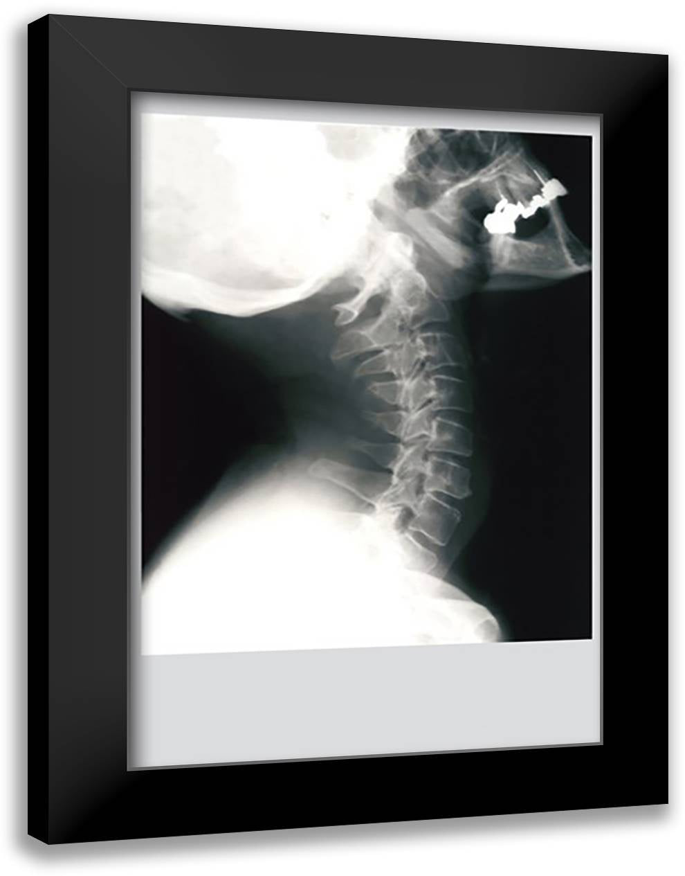 Skull and Neck 16x22 Black Modern Wood Framed Art Print Poster