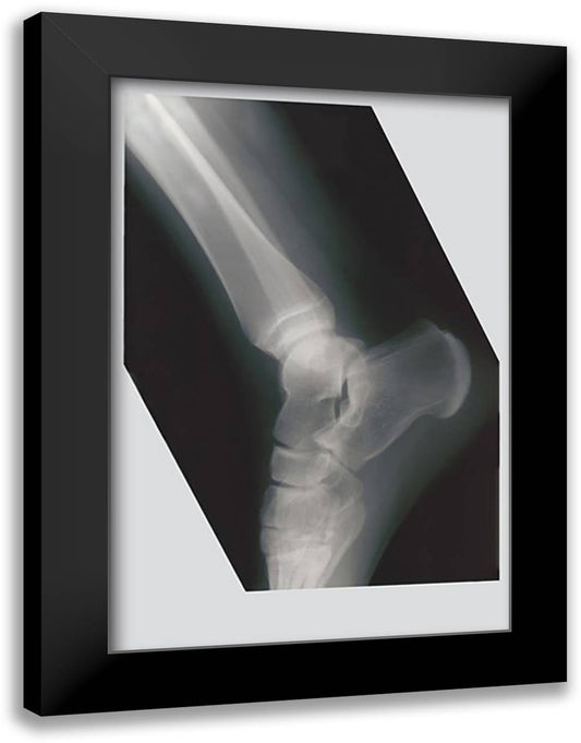 Ankle 16x22 Black Modern Wood Framed Art Print Poster