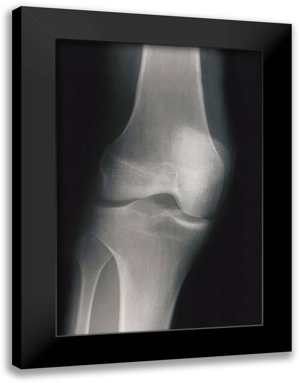 Knee 16x22 Black Modern Wood Framed Art Print Poster