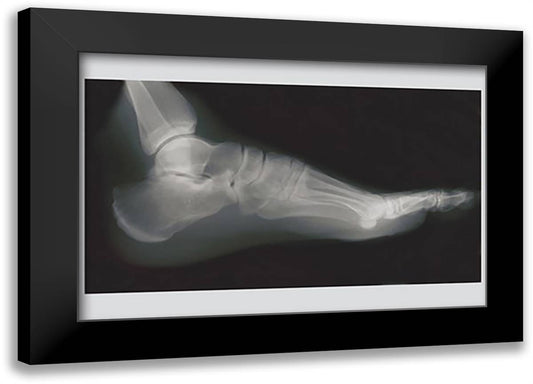 Foot 22x16 Black Modern Wood Framed Art Print Poster