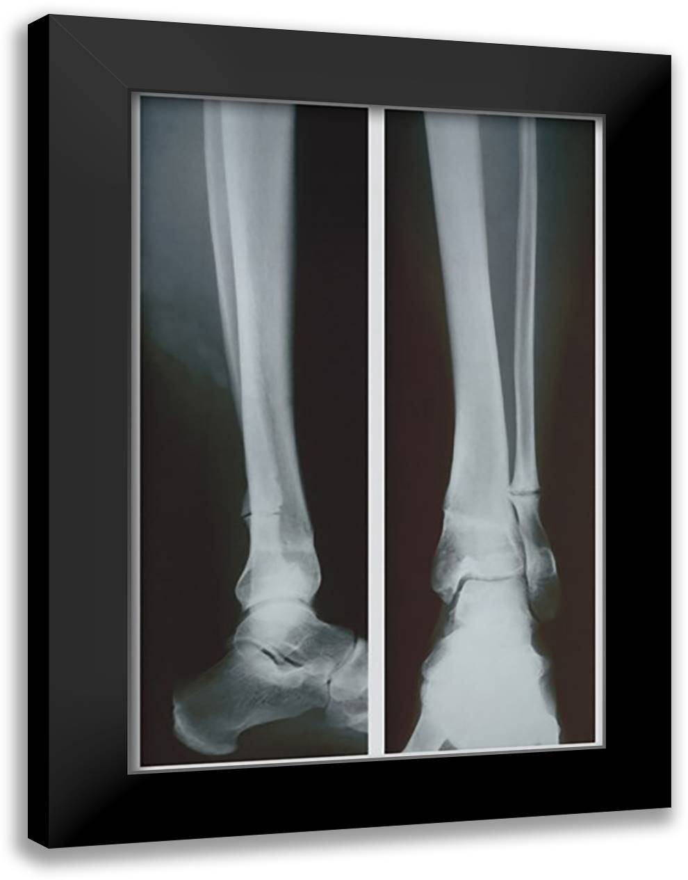 Two Ankles 16x22 Black Modern Wood Framed Art Print Poster