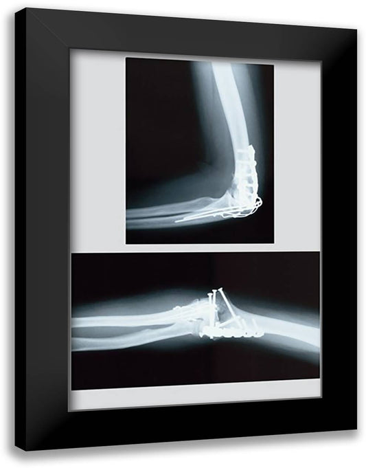 Repaired Elbow 16x22 Black Modern Wood Framed Art Print Poster