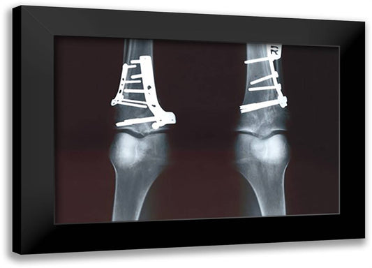 Fixed Tibia 22x16 Black Modern Wood Framed Art Print Poster