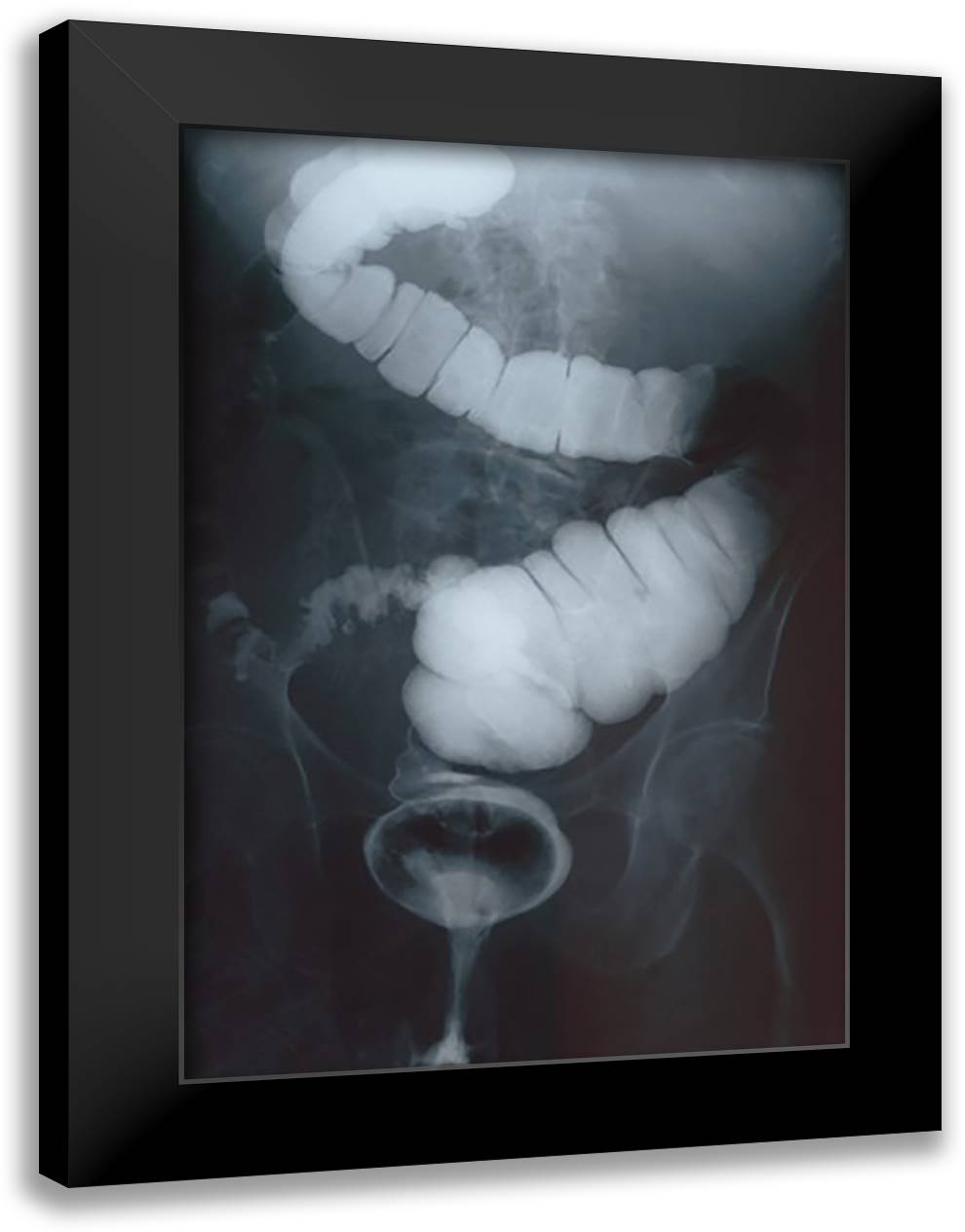 Intestine Barium 16x22 Black Modern Wood Framed Art Print Poster
