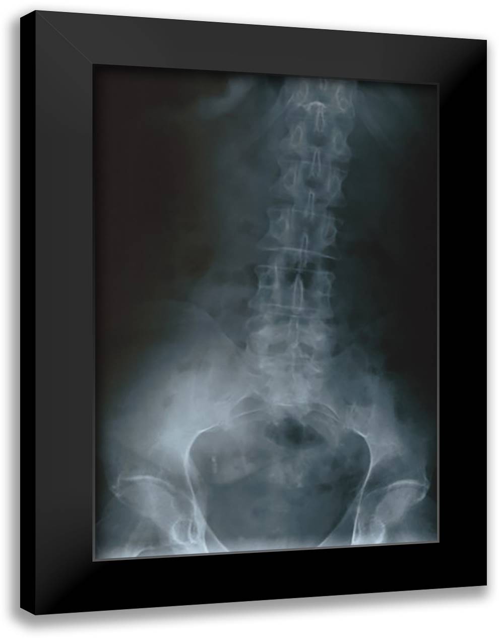 Lower Spine 16x22 Black Modern Wood Framed Art Print Poster