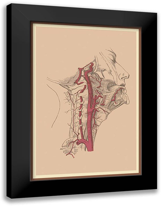 Internal Carotid Artery 16x22 Black Modern Wood Framed Art Print Poster