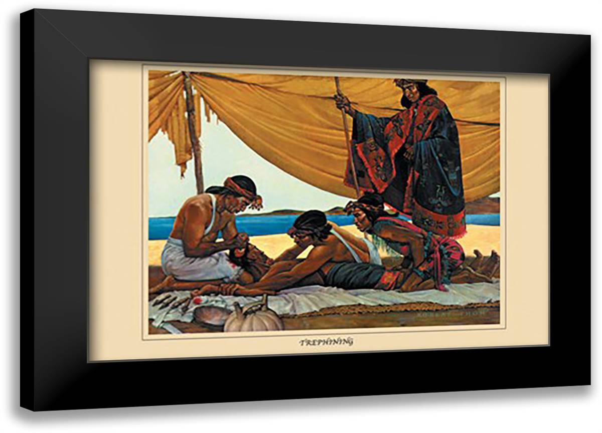 Trephining 22x16 Black Modern Wood Framed Art Print Poster by Thom, Robert