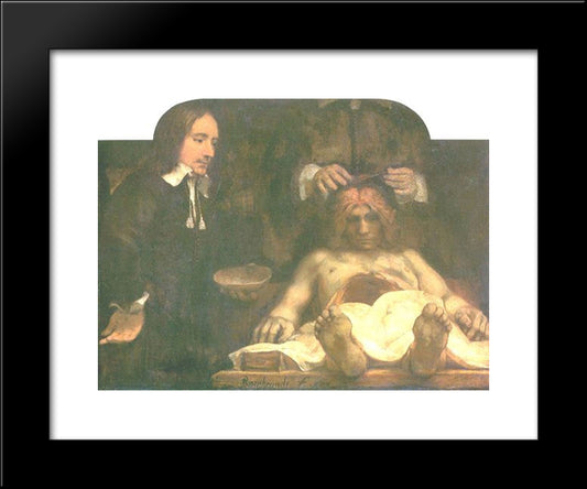 Anatomy Of Doctor Deyman 20x24 Black Modern Wood Framed Art Print Poster by Rembrandt