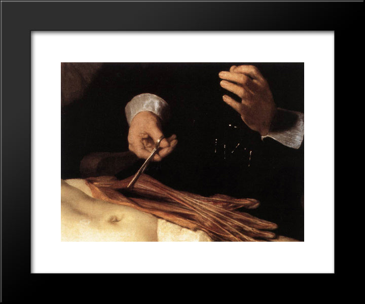 The Anatomy Lesson Of Dr. Nicolaes Tulp(Fragment) 20x24 Black Modern Wood Framed Art Print Poster by Rembrandt