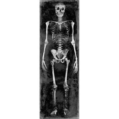 Skeleton II Black Modern Wood Framed Art Print with Double Matting by Wagner, Martin