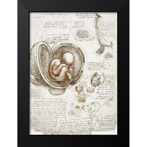 Studies of the Foetus in the Womb Black Modern Wood Framed Art Print by da Vinci, Leonardo